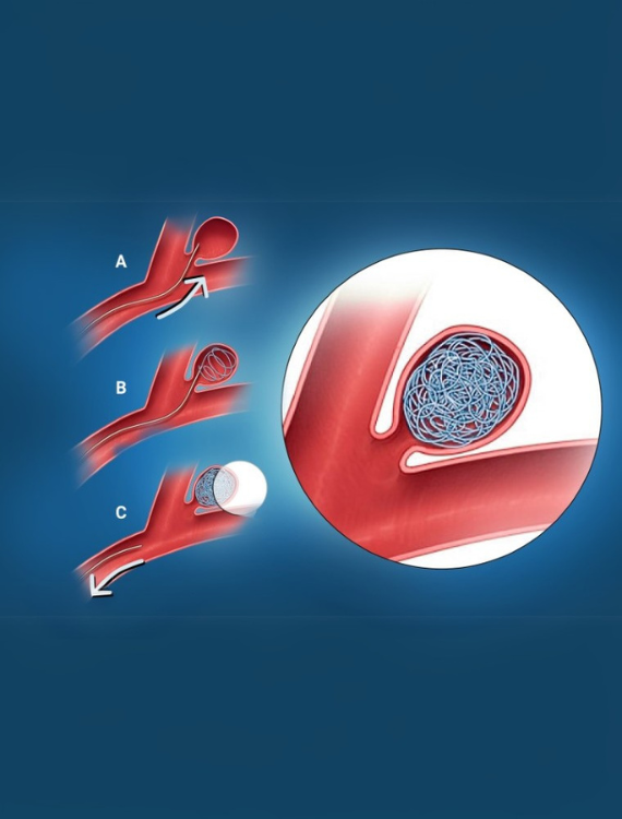 IR Machine